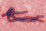 Ebola virus virion. Created by CDC microbiologist Cynthia Goldsmith, this colorized transmission electron micrograph (TEM) revealed some of the ultrastructural morphology displayed by an Ebola virus virion.