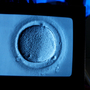 A doctor uses a microscrope to view a human egg during in vitro fertilization (IVF), which is used to fertilize eggs that have been frozen.