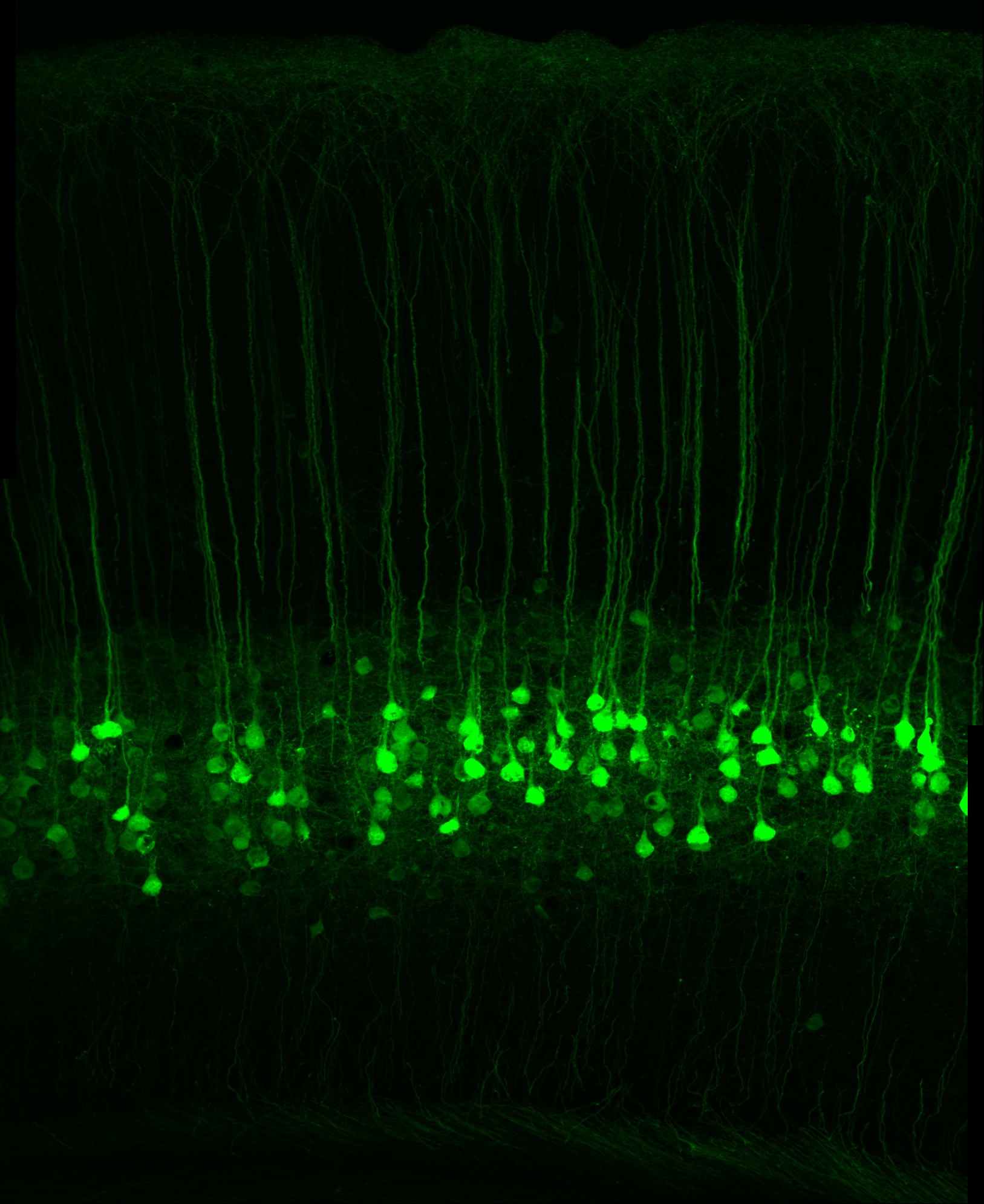 These fluorescently labeled neurons in the mouse somatosensory cortex are those that project to other regions of the brain.