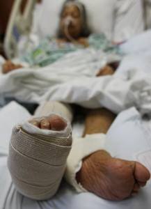 Photo: Another safety failure at Dallas' Parkland Memorial Hospital led to broken bones in elderly patient Sandra Mercado. It's the third time in the last seven months that the federal government has cited the embattled hospital. Read more by staff writer Miles Moffeit: http://share.d-news.co/cmeAB2O.