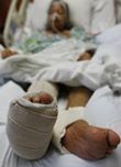 Another safety failure at Dallas' Parkland Memorial Hospital led to broken bones in elderly patient Sandra Mercado. It's the third time in the last seven months that the federal government has cited the embattled hospital. Read more by staff writer Miles Moffeit: http://share.d-news.co/cmeAB2O.