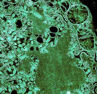 Image: Rabies Virus