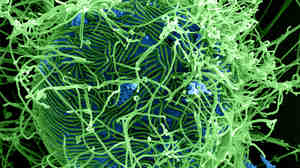 Magnified 25,000 times, this digitally colorized scanning electron micrograph shows Ebola virus particles (green) budding from an infected cell (blue).