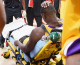 Julius Randle of the Los Angeles Lakers holds his head as he is wheeled away in a stretcher, October 28, 2014 against the Houston Rockets at Staples Center in Los Angeles, California. The rookie forward Randle, 19, reportedly suffered a broken leg during his NBA debut against the Rockets. (credit: ROBYN BECK/AFP/Getty Images)