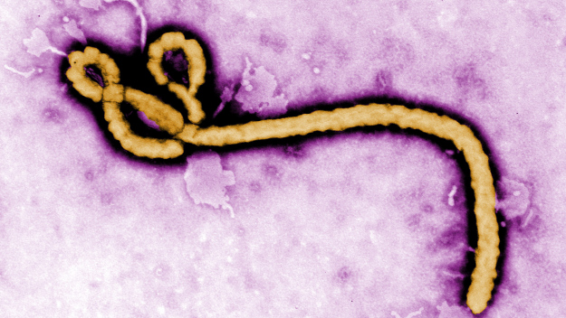 UNDATED:  In this handout from the Center for Disease Control (CDC), a colorized transmission electron micrograph (TEM) of a Ebola virus virion is seen. As the Ebola virus continues to spread across parts of Africa, a second doctor infected with the disease has arrived in the U.S. for treatment.  (Photo by Center for Disease Control (CDC) via Getty Images)