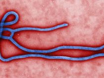An Ebola virus virion. (Centers for Disease Control and Prevention)