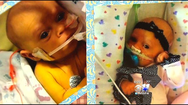 Family Fights Medicaid To Cover Surgery For 4-Month-Old