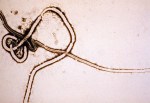 In this handout from the Center for Disease Control (CDC), an Electron Micrograph of the Ebola Virus is seen. (CDC via Getty Images)