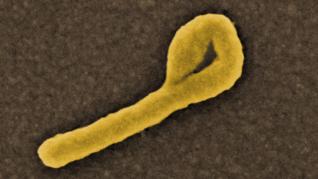 Does the presence of the Ebola virus in Dallas scare you?