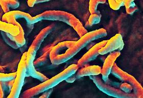 Electron micrograph of Ebola virus