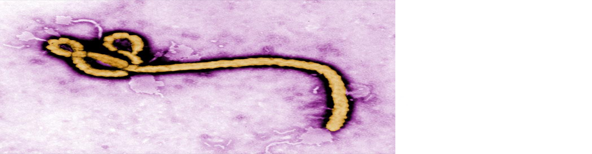 Protecting Workers from Ebola Virus