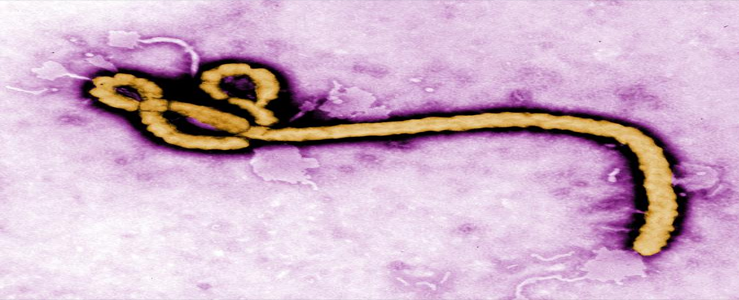 Protecting Workers from Ebola Virus 