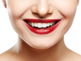 Top 5 Ways to Get Whiter Teeth for Free
