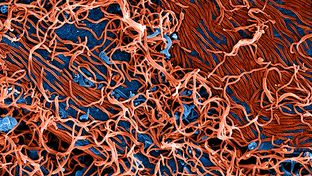 Colorized scanning electron micrograph of filamentous Ebola virus particles (red) attached and budding from a chronically infected VERO E6 cell (blue) (25,000x magnification).