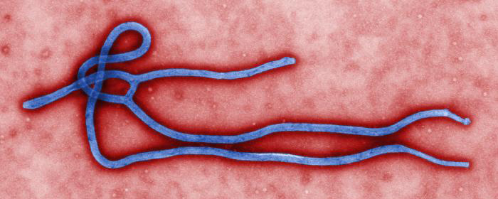Ebola Scare at Newtown Doctor's Office Prompts Emergency Response