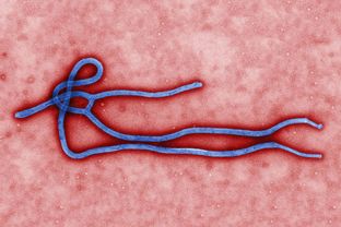 Ebola virus virion. Created by CDC microbiologist Cynthia Goldsmith, this colorized transmission electron micrograph (TEM) revealed some of the ultrastructural morphology displayed by an Ebola virus virion.