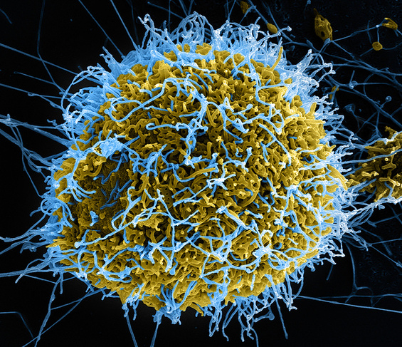 ebolaparticle.jpg
