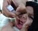 Researchers identify vaccine-resistant strain of polio