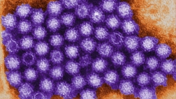 School officials in Boston confirmed that an outbreak of Norovirus has sickened about  students and  staff.