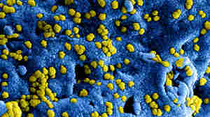 Middle Eastern Respiratory Syndrome virus particles cling to the surface of an infected cell.
