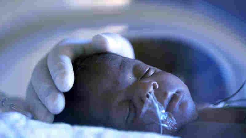 Premature infants in a neonatal intensive care unit may be exposed to DEHP, a chemical in some PVC medical equipment.