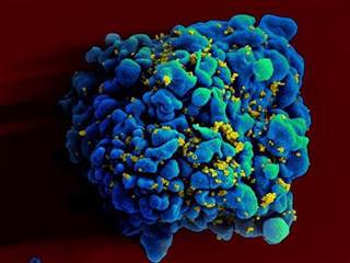 Semen Boosts AIDS Virus, Study Finds