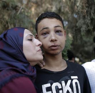 Image: Tariq Abu Khder (C), a Palestinian-US teenager who was allegedly beaten during police custody