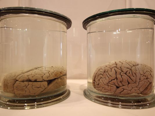 The Wellcome Collections Unveils Their New Exhibition Brains