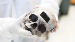 As with this skull, a small section of bone was removed from the Austin skull for DNA testing.