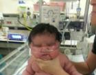 Mia Yasmin Hernandez was born by cesarean section Monday in Alamosa, weighing 13 pounds, 13 ounces. She was flown to a hospital outside Denver because she had low glucose levels and trouble breathing.