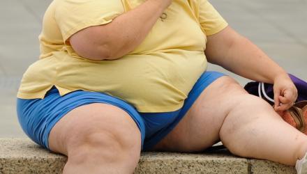 Study: Obesity takes eight years off your life