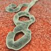Kaiser ramps up Ebola preparedness, scores in Sacramento and Oakland