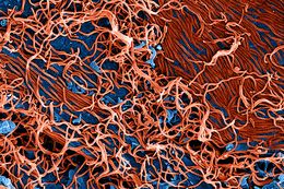Colorized scanning electron micrograph of filamentous Ebola virus particles (red) attached and budding from a chronically infected VERO E6 cell (blue) (25,000x magnification).