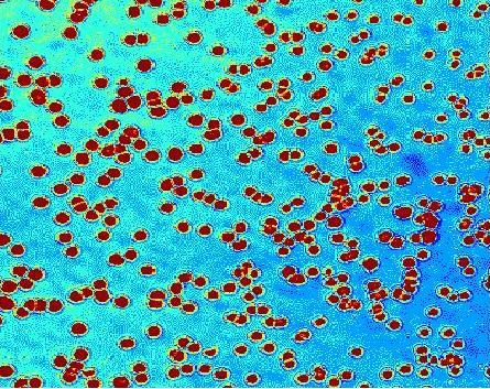 Enhanced image from early state of dewetting of polystyrene film on silicon substrate.