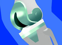 Conference artwork depicting a stylized artifical knee joint.