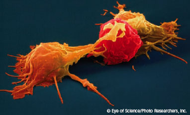Two natural killer cells attack a cancer cell - Graphic