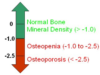 Figure 2: Interpreting Bone Mineral Density Scores