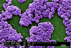 Cross-Contamination of Clinical Specimens with Bacillus anthracis During a Laboratory Proficiency Test --- Idaho, 2006