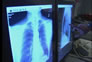 Photo thumbnail: Butner Radiology Department