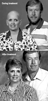 East Georgia Healthcare breast cancer survivor, during and after treatment
