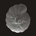 photo of a elphidium galvestonese mexicanum foram