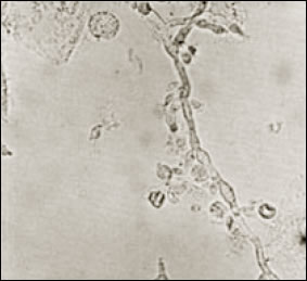 Plate 3:  Candida. Picture of the view through a high-power microscope of several Candida albicans, including individual yeast cells and groups of the single-celled fungus.