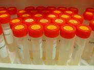 Image of test tubes with red tops.