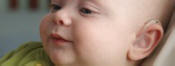 Photo of infant with hearing loss