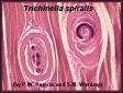 Trichinella cyclospora