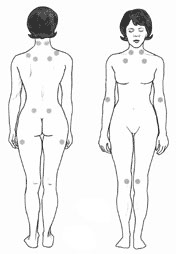 The location of the nine paired tender points that comprise the 1990 American College of Rheumatology criteria for fibromyalgia