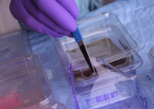 This photo shows a researcher working with acryl amide gels to separate proteins