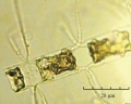 plankton image 2 of 3