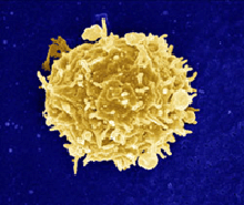 a scanning electron micrograph of a T Cell.