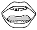 Illustration: Teeth with cavities